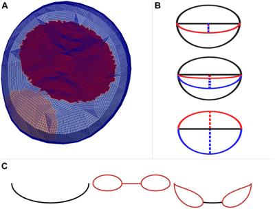 Computational Analysis of Flow Structures in Turbulent Ventricular Blood Flow Associated With Mitral Valve Intervention